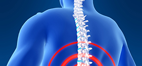 Back Pain