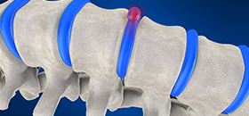 About Chiropractic